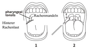 Oropharyngealer Abstrich (OP-Abstrich)