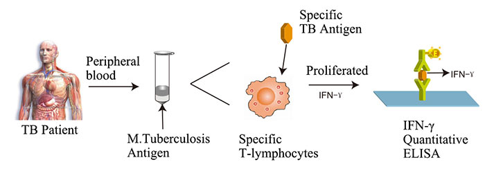 Tuberculosis (TB) Rapid Test Kit