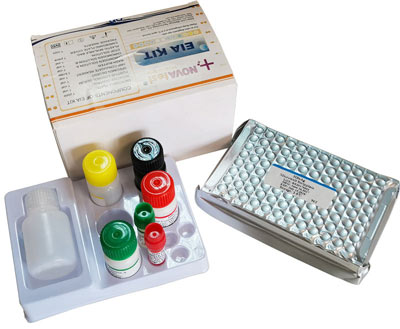 anti-TP ELISA Kit anti-TP ELISA Kit