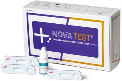 Mycoplasma Antibody Rapid Test Kits